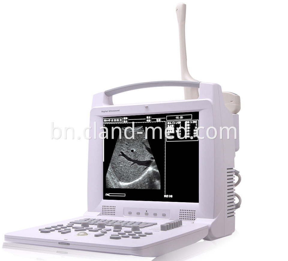 Pl 3018i Full Digital Portable Ultrasound Scanner 18